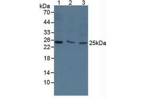 Figure. (TK1 anticorps  (AA 2-234))