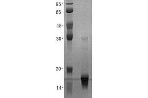 Protein CutA (CUTA) (Transcript Variant 1) protein (His tag)