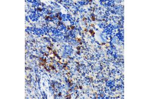 Immunohistochemistry of paraffin-embedded mouse spleen using CSK Rabbit mAb (ABIN1513217, ABIN3021034, ABIN3021035 and ABIN7101334) at dilution of 1:100 (40x lens).