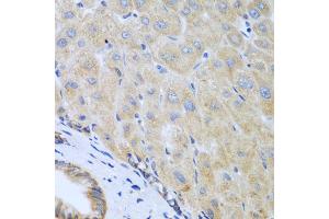 Immunohistochemistry of paraffin-embedded human liver using IL5 antibody (ABIN5975164) at dilution of 1/100 (40x lens). (IL-5 anticorps)