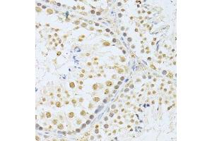 Immunohistochemistry of paraffin-embedded mouse testis using AKT1 antibody. (AKT1 anticorps  (C-Term))