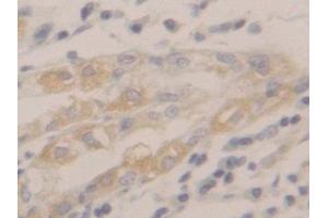 IHC-P analysis of Human Stomach Tissue, with DAB staining. (Peroxiredoxin 2 anticorps  (AA 6-164))