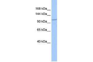 WB Suggested Anti-IFT122 Antibody Titration: 0. (IFT122 anticorps  (C-Term))