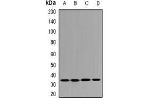 Western blot analysis of DHRS9 expression in HT29 (A), THP1 (B), mouse pancreas (C), rat trachea (D) whole cell lysates. (DHRS9 anticorps)