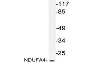 Western blot: analysis of NDUFA4 antibody staining in extracts from RAW264. (NDUFA4 anticorps)