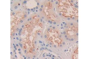 Used in DAB staining on fromalin fixed paraffin- embedded Kidney tissue (ITGA8 anticorps  (AA 907-1063))