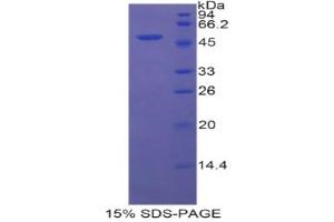 SDS-PAGE analysis of Rat FSIP1 Protein. (FSIP1 Protéine)