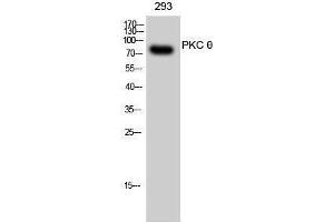 Western Blotting (WB) image for anti-Protein Kinase C, theta (PRKCQ) (Thr319) antibody (ABIN3186479) (PKC theta anticorps  (Thr319))