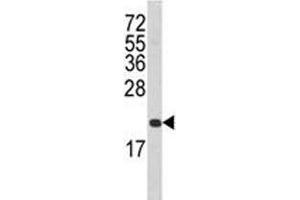 Western blot analysis of FAS antibody and T47D lysate.
