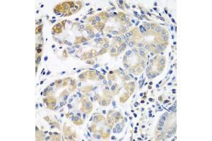 Immunohistochemistry of paraffin-embedded human stomach using PLS3 antibody (ABIN5971877) at dilution of 1/100 (40x lens). (Plastin 3 anticorps)