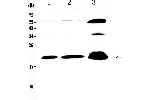 Western blot analysis of CPI17 alpha using anti- CPI17 alpha antibody . (CPI-17 anticorps  (AA 30-126))