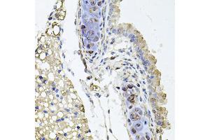 Immunohistochemistry of paraffin-embedded mouse lung using RHOT1 antibody (ABIN5973450) at dilution of 1/100 (40x lens).