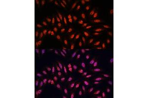 Immunofluorescence analysis of U-2 OS cells using KLHL8 antibody (ABIN7268081) at dilution of 1:100. (KLHL8 anticorps  (AA 271-620))