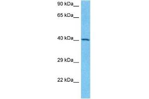 Host:  Rabbit  Target Name:  SNIP1  Sample Type:  Jurkat Whole Cell lysates  Antibody Dilution:  1.