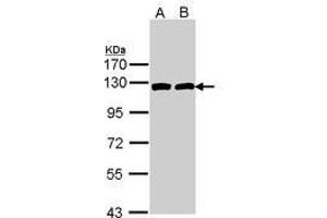 Image no. 1 for anti-ATP Citrate Lyase (ACLY) (AA 793-1008) antibody (ABIN467566) (ACLY anticorps  (AA 793-1008))