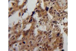 Used in DAB staining on fromalin fixed paraffin-embedded ovary tissue (PPIA anticorps  (AA 2-164))