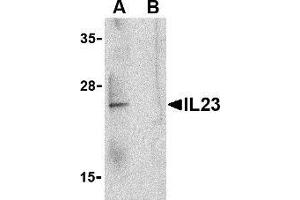Western blot analysis of IL-23 in Raji lysate with AP30418PU-N IL-23 antibody at 1 μg/ml in the (A) absence and (B) presence of blocking peptide.