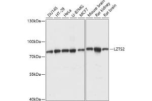 Western blot analysis of extracts of various cell lines, using LZTS2 antibody (ABIN7268227) at 1:1000 dilution.