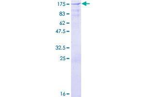 Image no. 1 for Cbl Proto-Oncogene B, E3 Ubiquitin Protein Ligase (CBLB) (AA 1-982) protein (GST tag) (ABIN1348172)