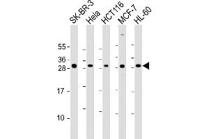 All lanes : Anti-N Antibody (Center) at 1:2000 dilution Lane 1: SK-BR-3 whole cell lysate Lane 2: Hela whole cell lysate Lane 3: HC whole cell lysate Lane 4: MCF-7 whole cell lysate Lane 5: HL-60 whole cell lysate Lysates/proteins at 20 μg per lane. (NAA10 anticorps  (AA 135-167))