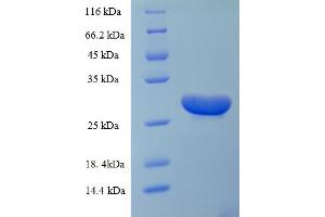 SDS-PAGE (SDS) image for Brain-Derived Neurotrophic Factor (BDNF) (AA 129-247) protein (His-SUMO Tag) (ABIN5709133)