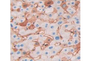 Used in DAB staining on fromalin fixed paraffin- embedded Kidney tissue