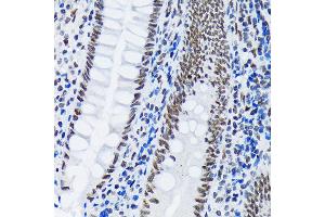 Immunohistochemistry of paraffin-embedded human appendix using PI+PI Rabbit mAb (ABIN7266879) at dilution of 1:100 (40x lens). (E3 SUMO-Protein Ligase PIAS3 (LOC101740849) anticorps)