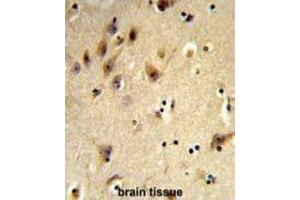 Immunohistochemistry (IHC) image for anti-Histone H2A Type 1-H (HIST1H2AH) antibody (ABIN3003926)