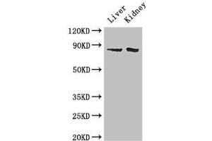 Western Blot Positive WB detected in: Mouse liver tissue, Mouse kidney tissue All lanes: SMO antibody at 2 μg/mL Secondary Goat polyclonal to rabbit IgG at 1/50000 dilution Predicted band size: 87 kDa Observed band size: 87 kDa (SMO anticorps  (AA 28-233))