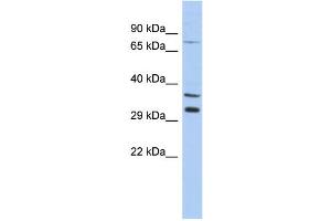 WB Suggested Anti-TSGA13 Antibody Titration: 0. (TSGA13 anticorps  (Middle Region))
