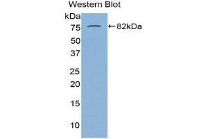 Western Blotting (WB) image for anti-serpin Peptidase Inhibitor, Clade A (Alpha-1 Antiproteinase, Antitrypsin), Member 10 (SERPINA10) (AA 22-448) antibody (ABIN1863312) (SERPINA10 anticorps  (AA 22-448))
