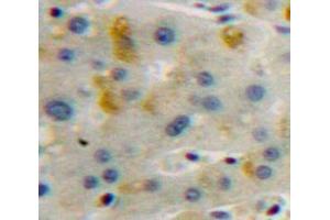 Used in DAB staining on fromalin fixed paraffin-embedded Liver tissue