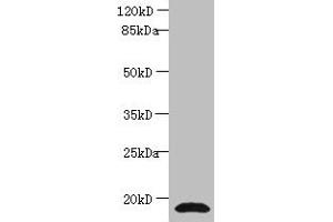Western blot All lanes: CST3 antibody at 2 μg/mL + Human positive serum Secondary Goat polyclonal to rabbit IgG at 1/15000 dilution Predicted band size: 16 kDa Observed band size: 16 kDa (CST3 anticorps  (AA 27-146))
