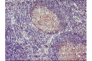 Image no. 4 for anti-Tropomodulin 1 (TMOD1) antibody (ABIN1501528)