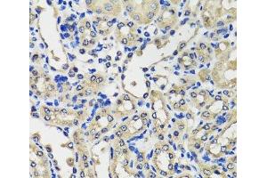 Immunohistochemistry of paraffin-embedded Mouse kidney using SCG3 Polyclonal Antibody at dilution of 1:100 (40x lens). (SCG3 anticorps)