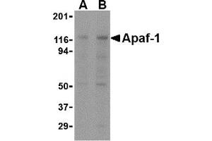 Western Blotting (WB) image for anti-Apoptotic Peptidase Activating Factor 1 (APAF1) antibody (ABIN1031715) (APAF1 anticorps)