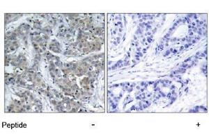 Image no. 1 for anti-Stathmin 1 (STMN1) (Ser15) antibody (ABIN197474)