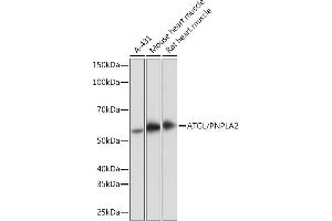 Western blot analysis of extracts of various cell lines, using ATGL/PNPL antibody (ABIN7269183) at 1:1000 dilution. (PNPLA2 anticorps)