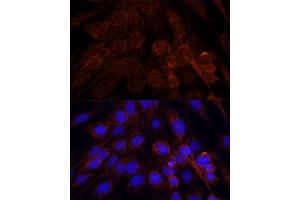 Immunofluorescence analysis of C6 cells using POLRMT antibody (ABIN7269460) at dilution of 1:100.