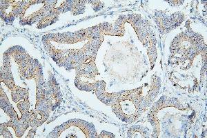 IHC analysis of PDCD6IP using anti-PDCD6IP antibody (ABIN7600490). (ALIX anticorps  (AA 2-330))