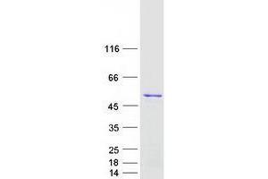 Validation with Western Blot