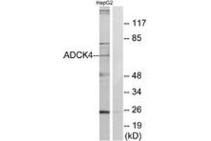 Western Blotting (WB) image for anti-AarF Domain Containing Kinase 4 (ADCK4) (AA 31-80) antibody (ABIN2889721) (ADCK4 anticorps  (AA 31-80))