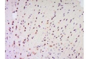 Formalin-fixed and paraffin embedded rat brain labeled with Anti-EXOSC7 Polyclonal Antibody, Unconjugated  at 1:200 followed by conjugation to the secondary antibody and DAB staining. (EXOSC7 anticorps  (AA 21-120))