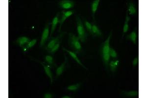 Immunofluorescence staining of Hela cells with ABIN7145800 at 1:266, counter-stained with DAPI. (BAZ2B anticorps  (AA 139-240))