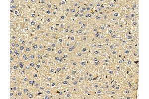 ABIN7096454 and ABIN7100518 at 1/100 staining mouse liver tissue by IHC-P. (UGT2B28 anticorps)