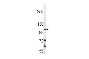 GUCY2F Antibody (C-term) (ABIN1537619 and ABIN2848622) western blot analysis in 293 cell line lysates (35 μg/lane). (GUCY2F anticorps  (C-Term))