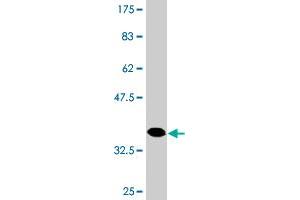 Western Blot detection against Immunogen (37.