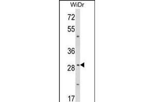 Western blot analysis of ZFP36 Antibody (Center) (ABIN652899 and ABIN2842580) in WiDr cell line lysates (35 μg/lane). (ZFP36 anticorps  (AA 116-142))