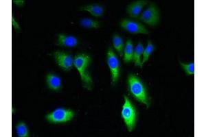 Immunofluorescent analysis of A549 cells using ABIN7172870 at dilution of 1:100 and Alexa Fluor 488-congugated AffiniPure Goat Anti-Rabbit IgG(H+L) (TRPM8 anticorps  (AA 1-192))