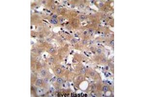 Immunohistochemistry (IHC) image for anti-Transient Receptor Potential Cation Channel, Subfamily M, Member 8 (TRPM8) antibody (ABIN2996363) (TRPM8 anticorps)